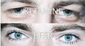 মাদক ও মাদকাসক্তি | মাদক দেহে ও মস্তিষ্কে কীভাবে কাজ করে ? (পর্ব ১)