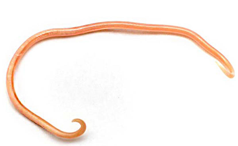 শিশুর কৃমি হবার কারণ লক্ষণ ও প্রতিরোধে করনীয় কী?