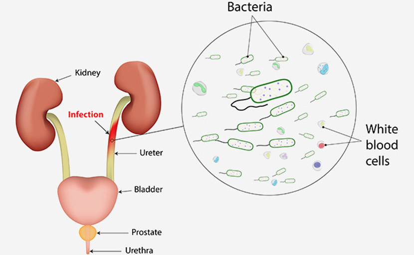 গর্ভাবস্থায় জরায়ুতে ব্যথা হওয়ার ৬টি ঝুঁকিপূর্ণ কারণ জানা আছে কি?
